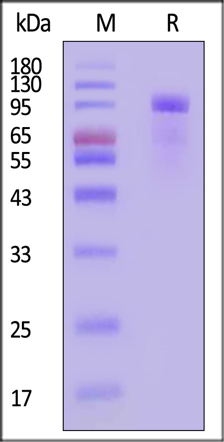 Her2 SDS-PAGE