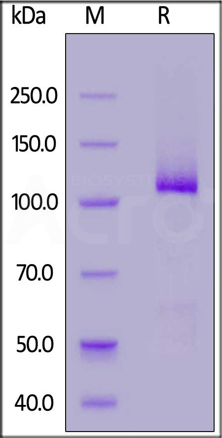 HGF SDS-PAGE