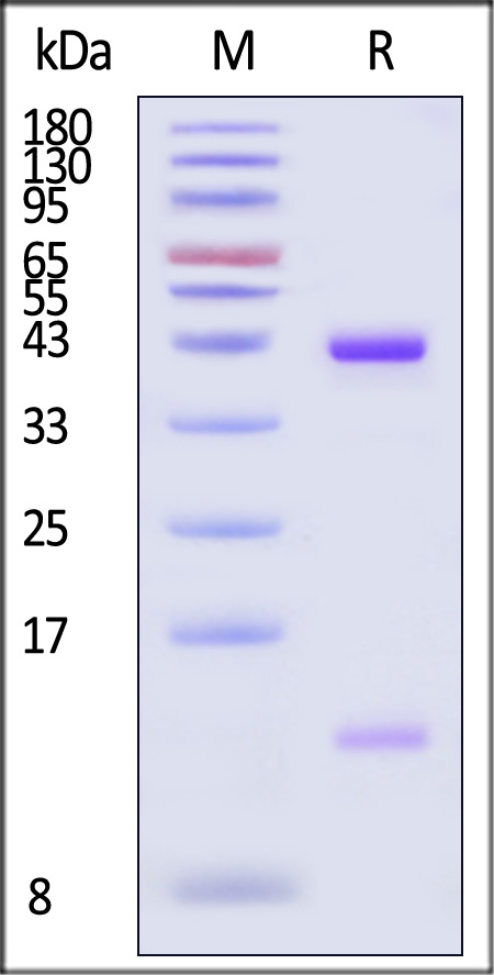 HLA-A*02:01 & B2M & NY-ESO-1 SDS-PAGE