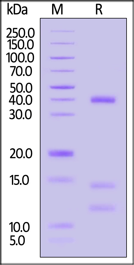 HLA-A*1101 | B2M | KRASG12D (VVGADGVGK) SDS-PAGE