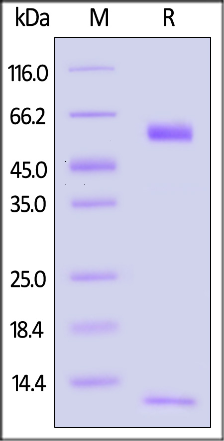 HLA-A*1101 | B2M | KRASG12D (VVGADGVGK) SDS-PAGE