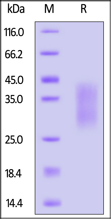 HVEM SDS-PAGE