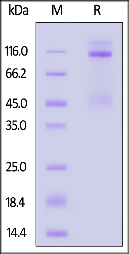 IGF-I R SDS-PAGE