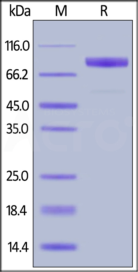 IL-1RL1 SDS-PAGE