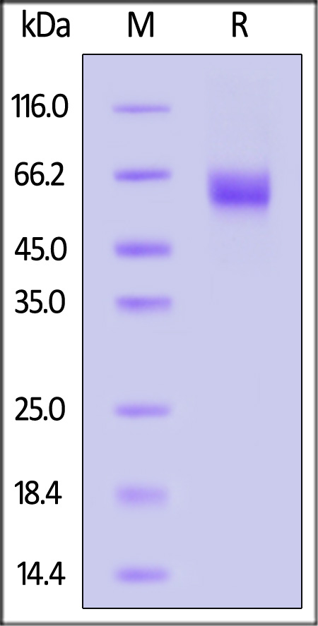 IL-1RL1 SDS-PAGE