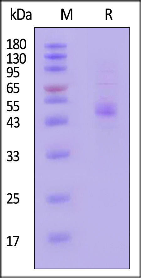 IL-15 SDS-PAGE