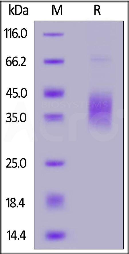 LAP (TGF-beta 1) SDS-PAGE