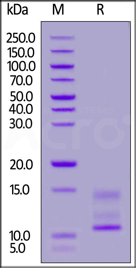 Cynomolgus Mucin-1, His Tag (Cat. No. MU1-C52H5) SDS-PAGE gel