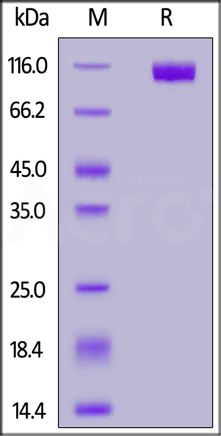 NCAM-1 SDS-PAGE