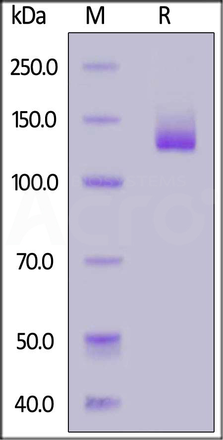 NCAM-1 SDS-PAGE