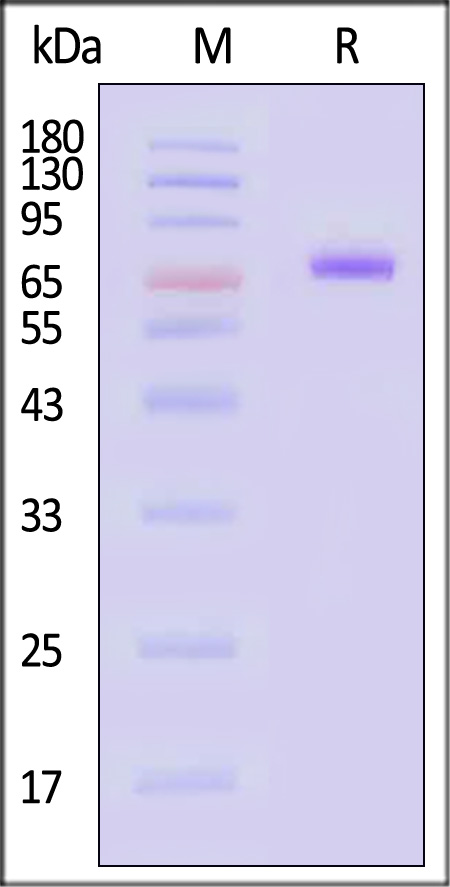 Neuraminidase (NA) SDS-PAGE