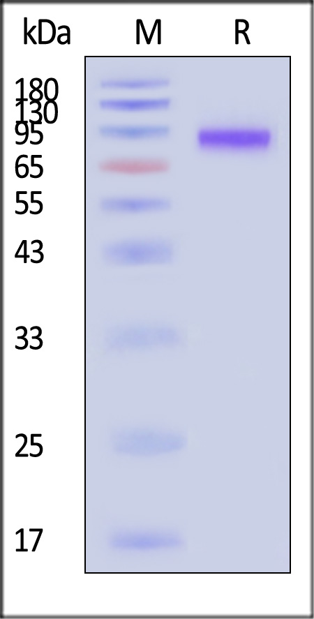 Neuraminidase (NA) SDS-PAGE