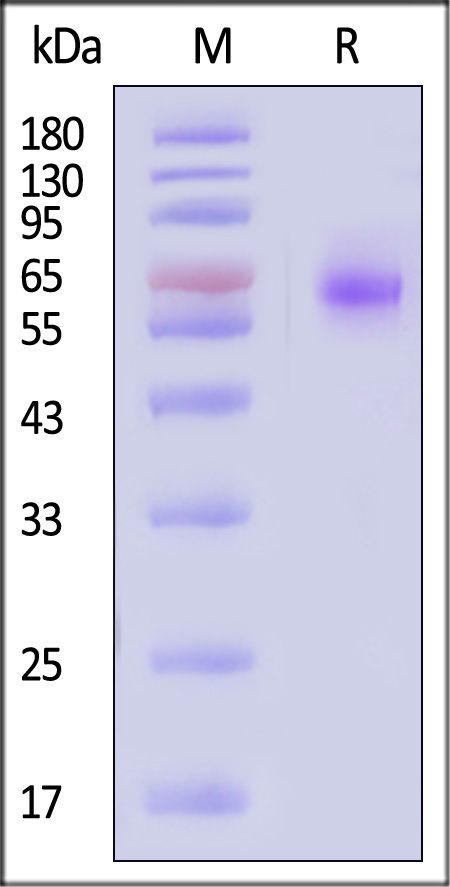 NGFR SDS-PAGE