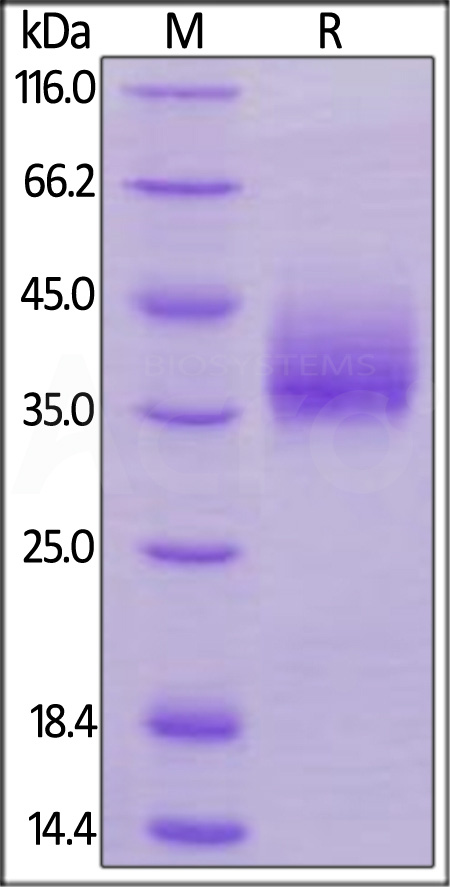 Human NTB-A, His Tag (Cat. No. NTA-H52Ha) SDS-PAGE gel