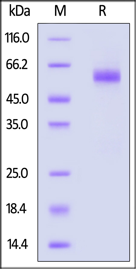 Nucleocapsid protein SDS-PAGE