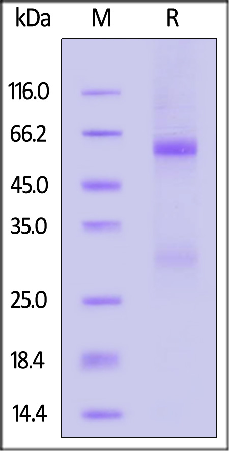 Nucleocapsid protein SDS-PAGE