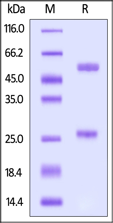 Nucleocapsid protein SDS-PAGE