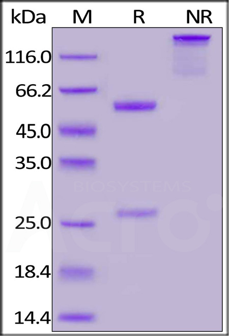 Nucleocapsid protein SDS-PAGE