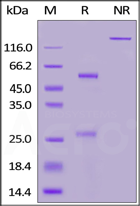 Nucleocapsid protein SDS-PAGE