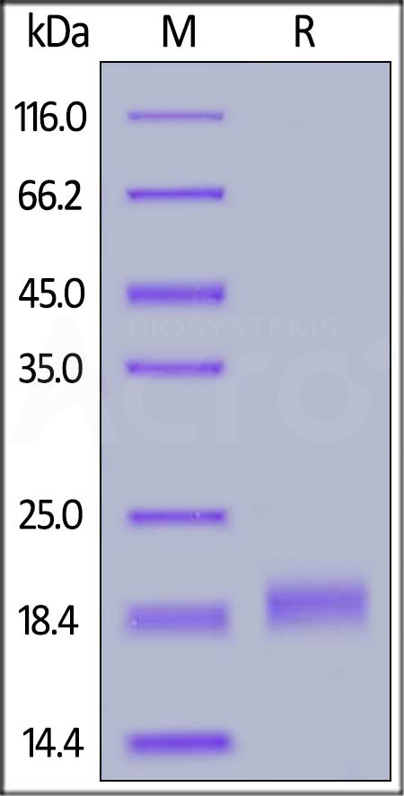 ROR1 SDS-PAGE