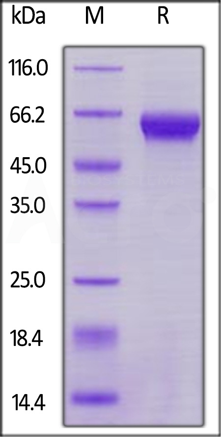 ROR1 SDS-PAGE