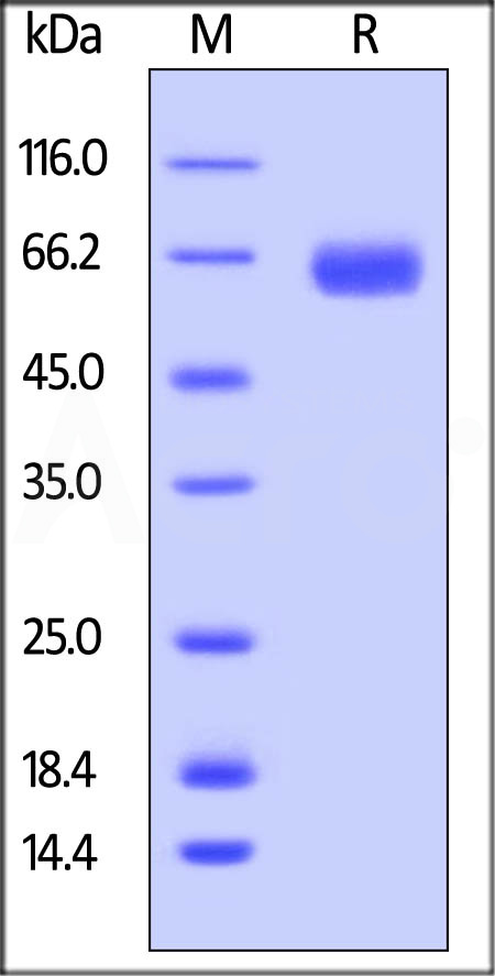 ROR1 SDS-PAGE