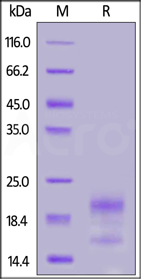 Human R-Spondin 3 (22-146), His Tag (Cat. No. RS6-H5222) SDS-PAGE gel