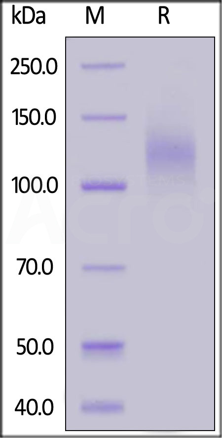 Spike S1 SDS-PAGE