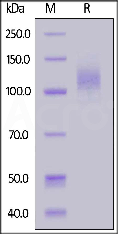 Spike S1 SDS-PAGE