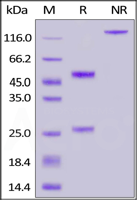 Spike S1 SDS-PAGE