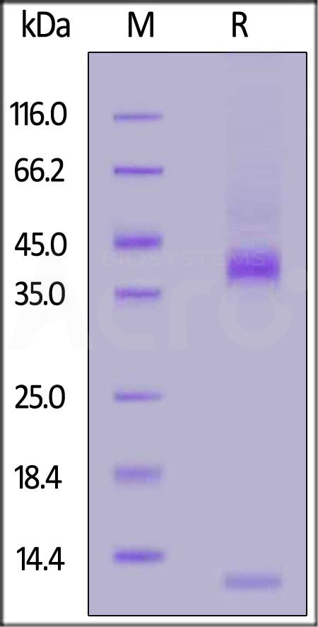 Latent TGF-beta 1 SDS-PAGE