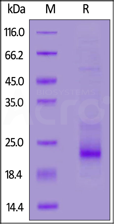 TRAIL R1 SDS-PAGE