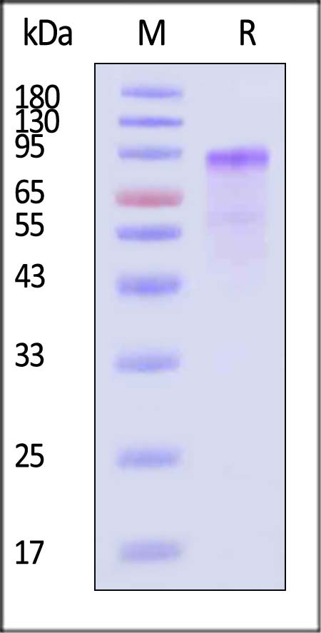 VLDL R SDS-PAGE